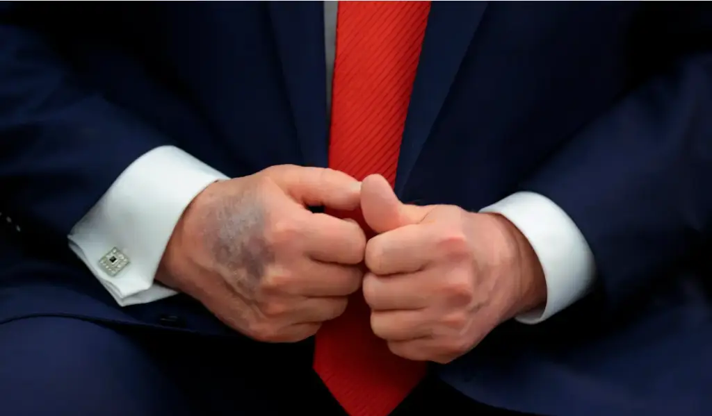 President Trump